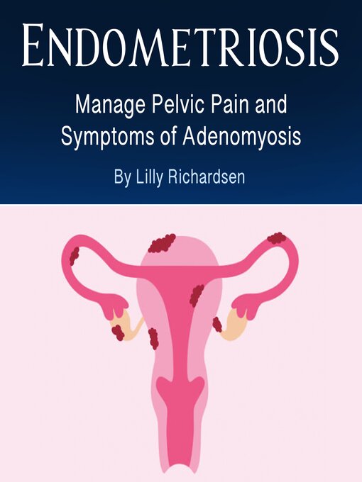 Title details for Endometriosis by Lily Richardsen - Available